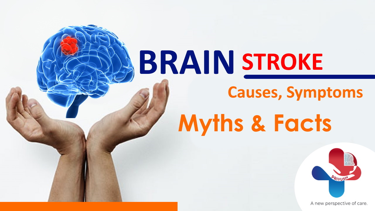 Brain Stroke Causes, Symptoms | Myths & Reality