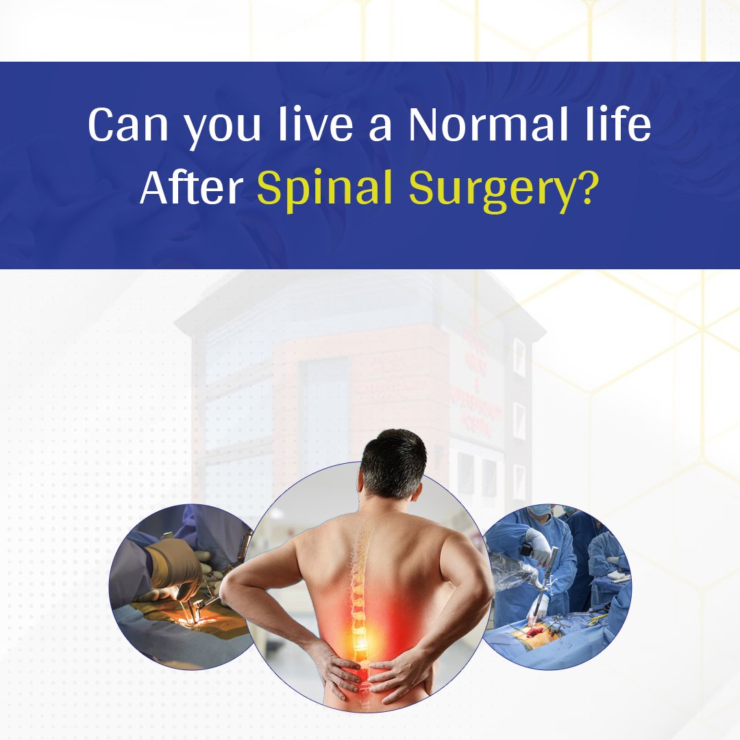 Can You Live a Normal Life after Spinal Surgery?